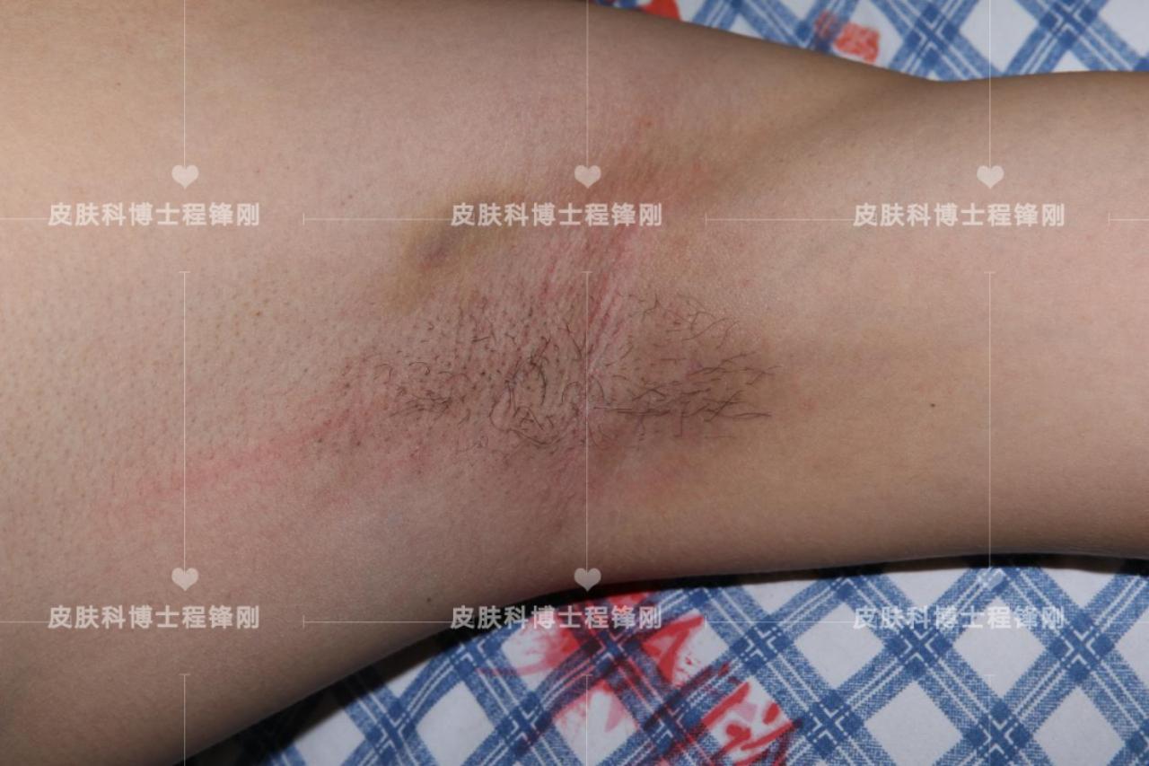 狐臭与军事生涯，一个关于选择、理解与包容的故事，军事生涯中的特殊篇章，狐臭与理解与包容的故事