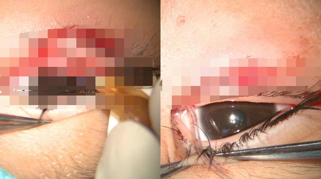 福建泉州发生伤害事件，深度探究与反思，福建泉州伤害事件深度探究与反思